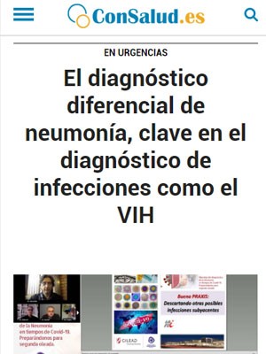El diagnóstico diferencial de neumonía, clave en el diagnóstico de infecciones como el VIH