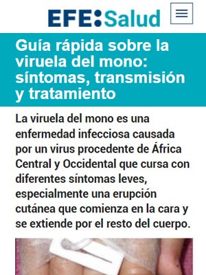 Guía rápida sobre la viruela del mono: síntomas, transmisión y tratamiento